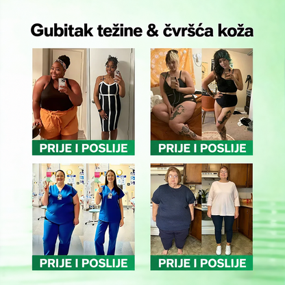 👑 𝑺𝒍𝒖ž𝒃𝒆𝒏𝒂 𝒕𝒓𝒈𝒐𝒗𝒊𝒏𝒂 | 🌿 𝑮𝑳𝑶𝑹𝑬𝑵𝑫𝑨® 𝑴𝒐𝒓𝒊𝒏𝒈𝒂 · 𝑩𝒆𝒓𝒃𝒆𝒓𝒊𝒏 × 𝑵𝑨𝑫+ 𝑵𝒂𝒑𝒓𝒆𝒅𝒏𝒊 𝒏𝒂𝒏𝒐-𝒎𝒊𝒌𝒓𝒐𝒊𝒈𝒍𝒊č𝒏𝒊 𝒇𝒍𝒂𝒔𝒕𝒆𝒓 10 𝒖 1 (Samo jednom dnevno, vidljive promjene u 7 dana) ✅ Za pretilost, opuštenu kožu, dijabetes, apneju u snu, probleme sa zglobovima i još mnogo toga 👨‍⚕️